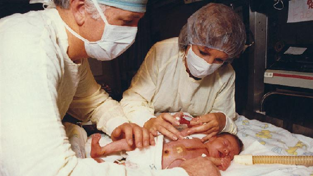 Leonard Bailey MD performed the world&rsquo;s first and only transplant of a baboon heart into a baby with hypoplastic left heart syndrome.